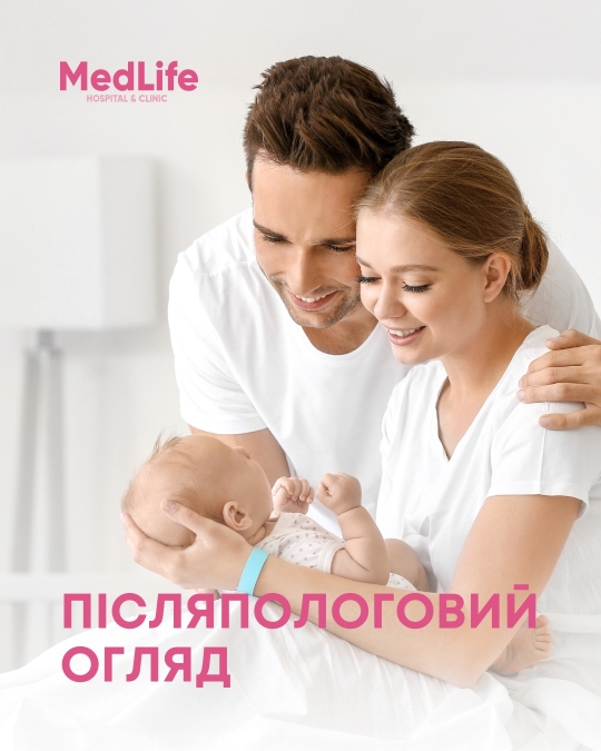Післяпологовий огляд